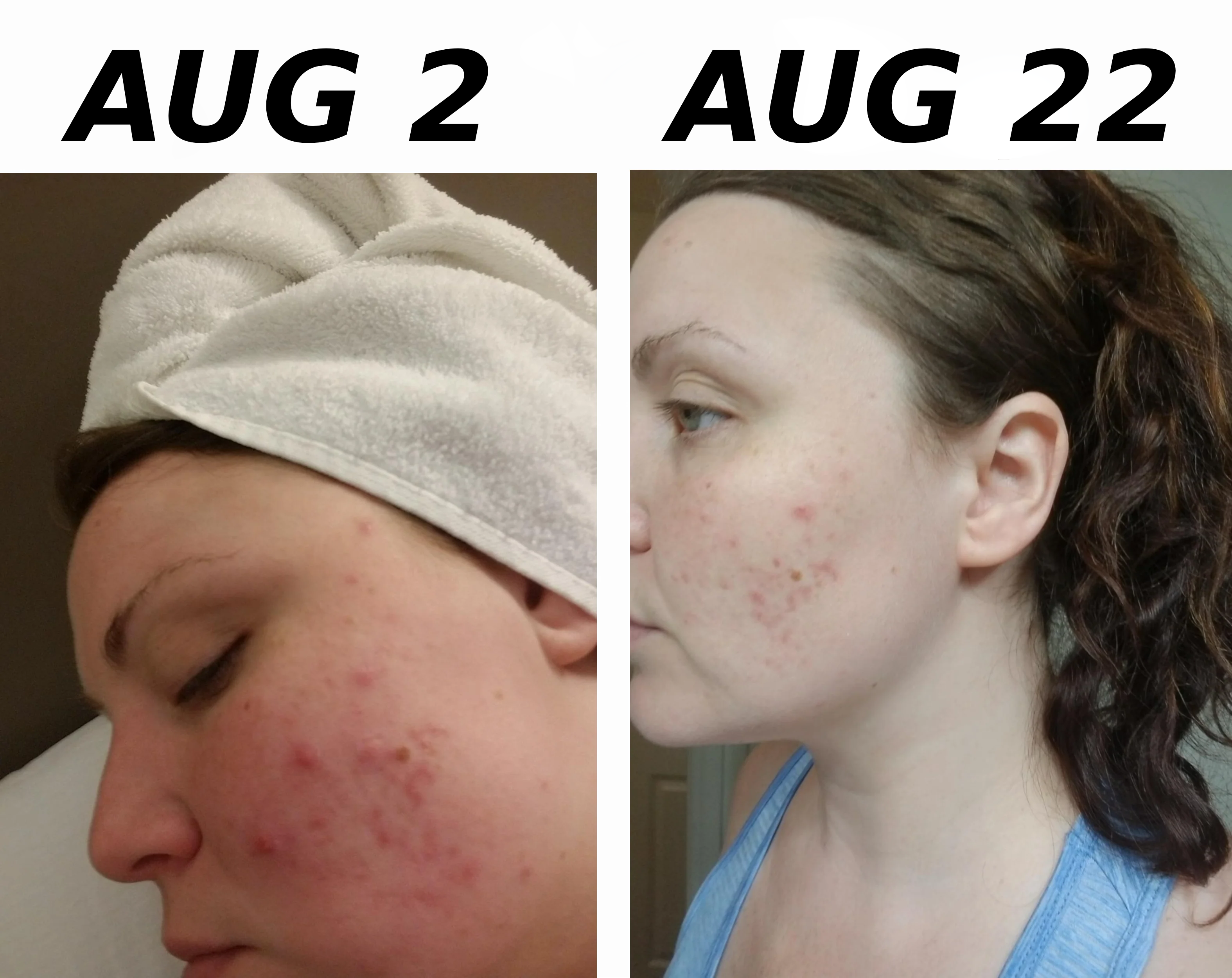 “Noticeable changes within weeks!”